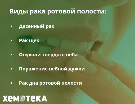 Лечение плоскоклеточного рака языка в ...